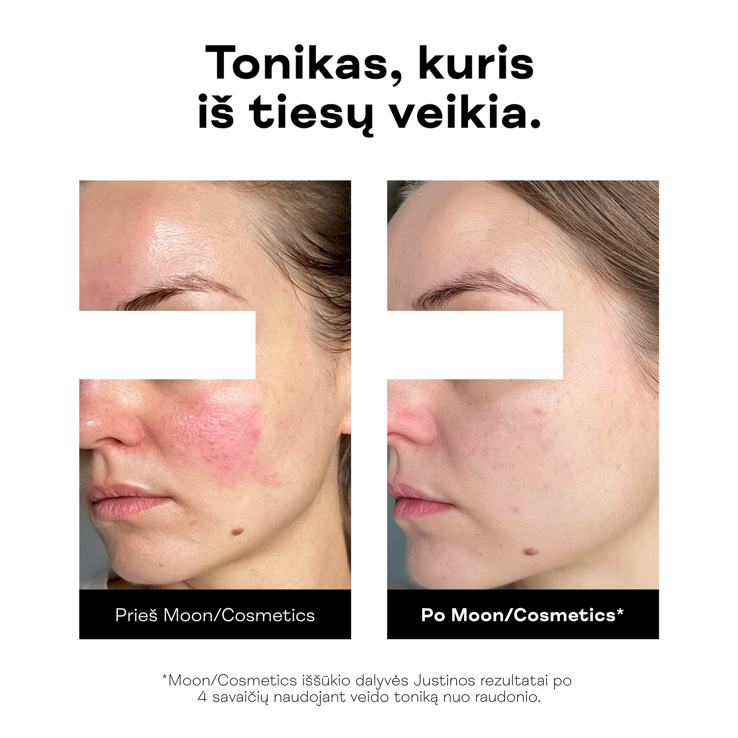 Veido tonikas nuo raudonio